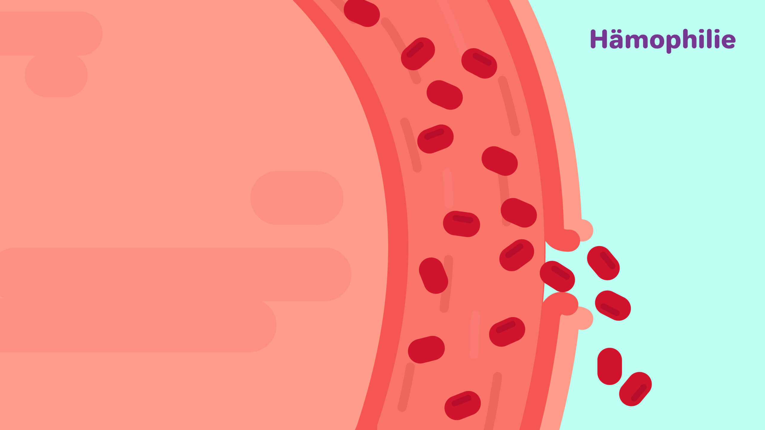 Bild aus Erklärvideo Hämophilie zeigt Blutung aus Blutgefäss